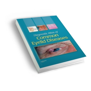 Diagnostic Atlas of Common Eyelid Diseases | Jonathan J. Dutton, Gregg S. Gayre, Alan D. Proia